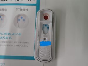 血液検査